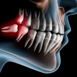 Oral Surgery