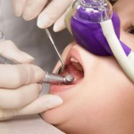 Nitrous Oxide Sedation