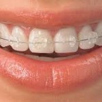 Orthodontics